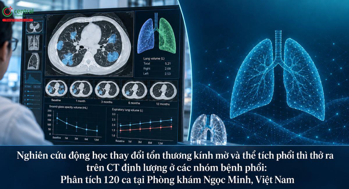 Nghiên cứu động học thay đổi tổn thương kính mờ và thể tích phổi thì thở ra trên CT định lượng ở các nhóm bệnh phổi: Phân tích 120 ca tại Phòng khám Ngọc Minh, Việt Nam