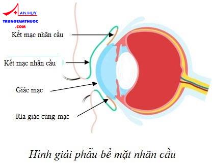 Tân sản vảy bề mặt nhãn cầu: nguyên nhân, triệu chứng và điều trị