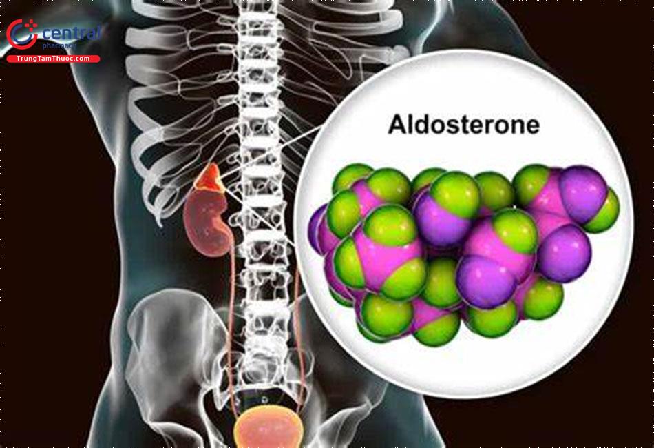 Nguyên nhân, triệu chứng và điều trị cường aldosteron tiên phát