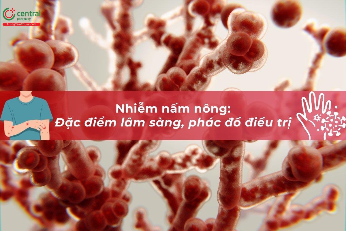 Nhiễm nấm nông bôi thuốc gì cho hết? Phác đồ điều trị, hình ảnh mô tả bệnh