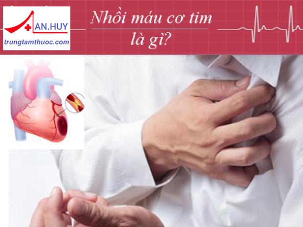 Nhồi máu cơ tim: nguyên nhân và dấu hiệu nhận biết
