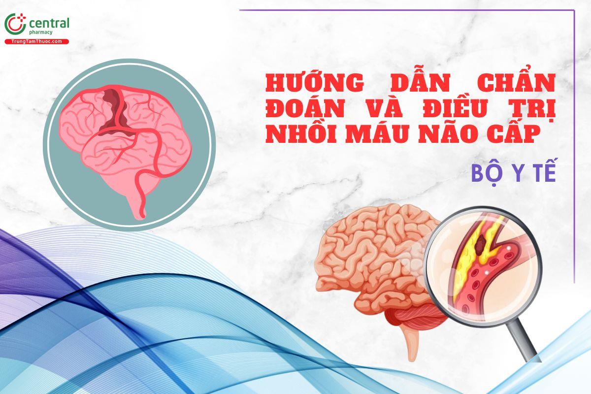 Hướng dẫn chẩn đoán và điều trị nhồi máu não cấp - Bộ Y tế