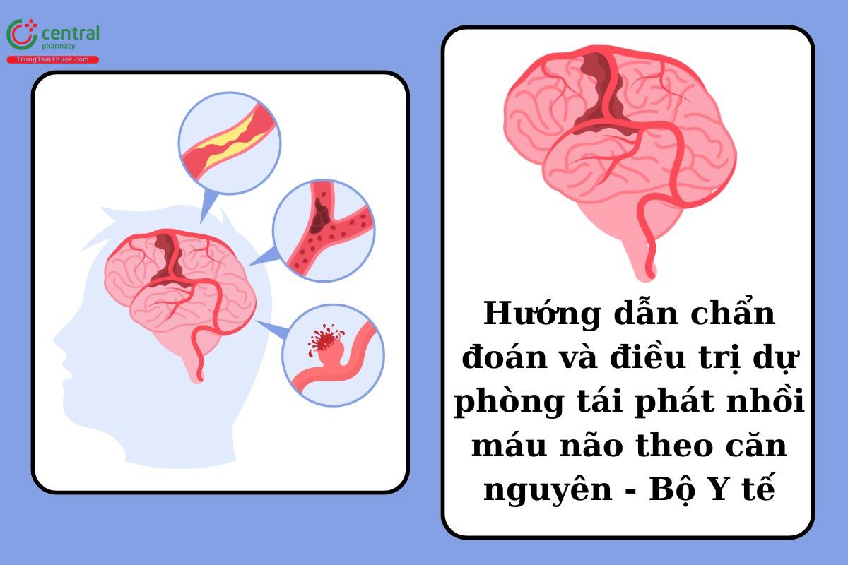 Hướng dẫn chẩn đoán và điều trị dự phòng tái phát nhồi máu não theo căn nguyên - Bộ Y tế