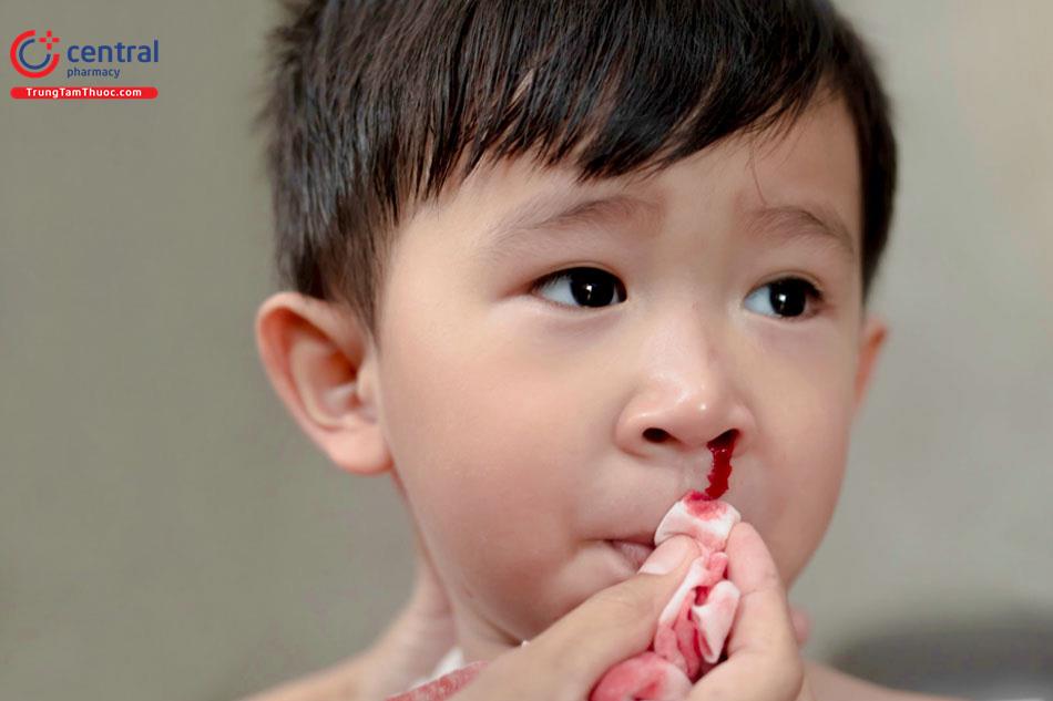 Phương pháp điều trị bệnh Hemophilia - bệnh ưa chảy máu ở trẻ em