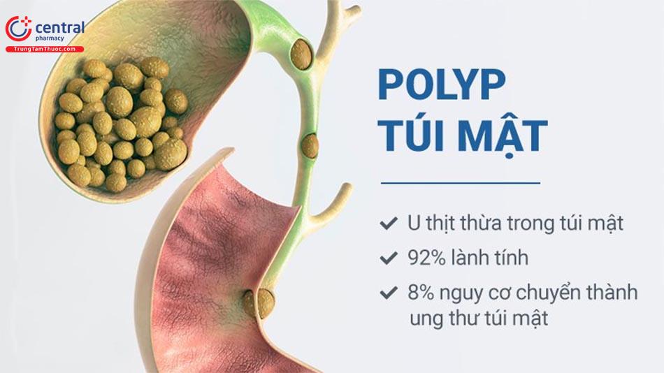 Polyp túi mật: yếu tố nguy cơ, triệu chứng và cách điều trị