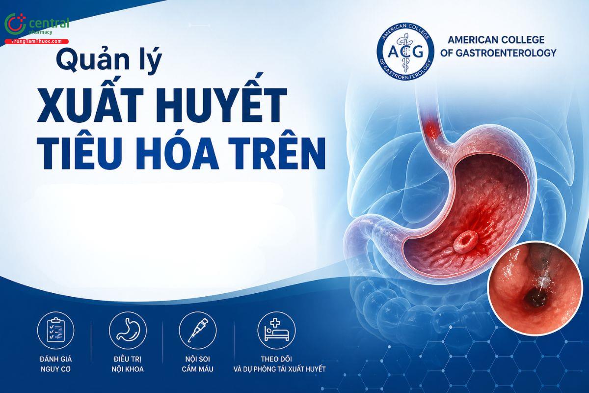 Quản lý xuất huyết tiêu hóa trên theo hướng dẫn của ACG 2021