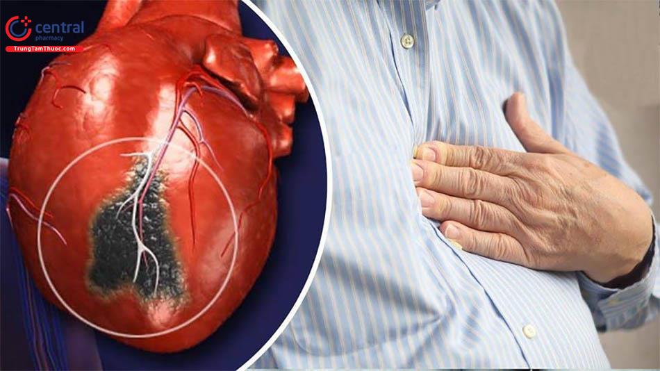 Quy trình chẩn đoán và điều trị thiếu máu cuc bộ cơ tim