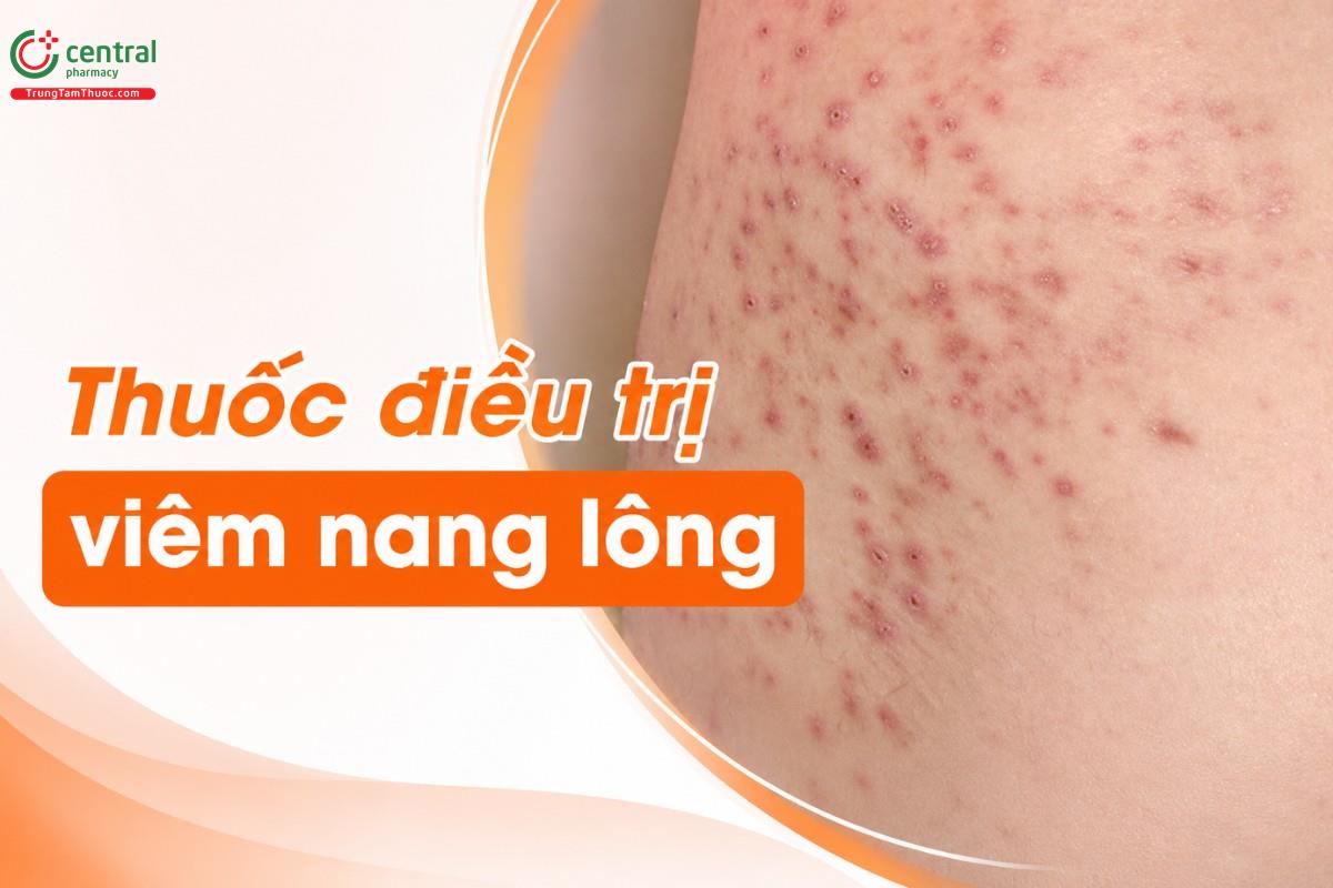 [REVIEW] 7+ thuốc trị viêm nang lông dứt điểm không thể bỏ lỡ