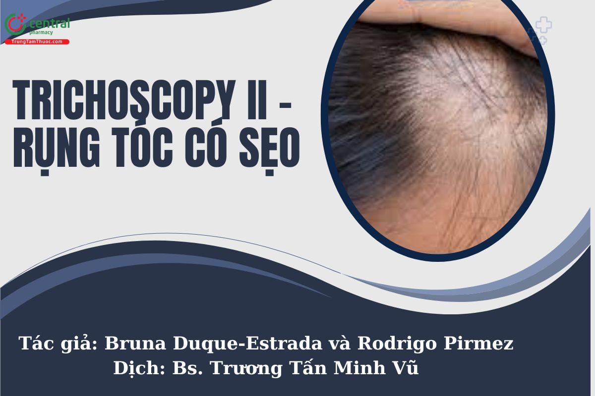 Điều trị rụng tóc có sẹo bằng phương pháp soi da đầu Trichoscopy