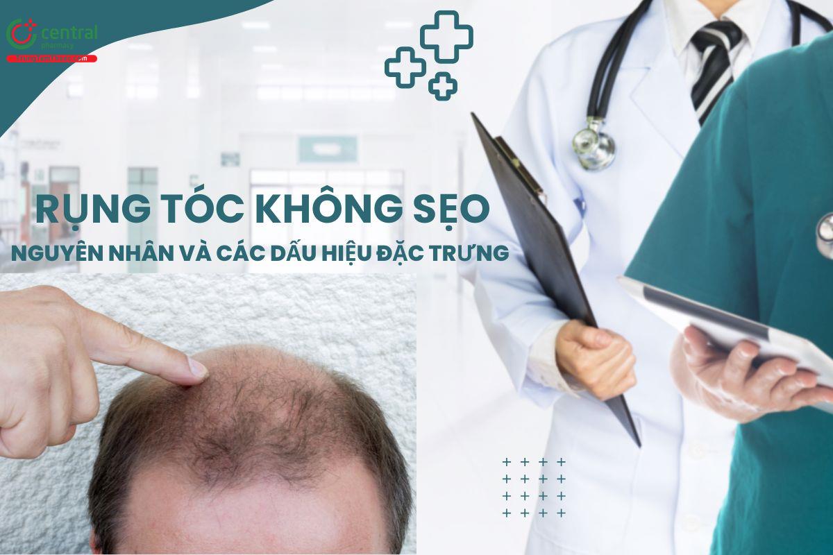 Điều trị rụng tóc không sẹo bằng phương pháp soi da đầu Trichoscopy