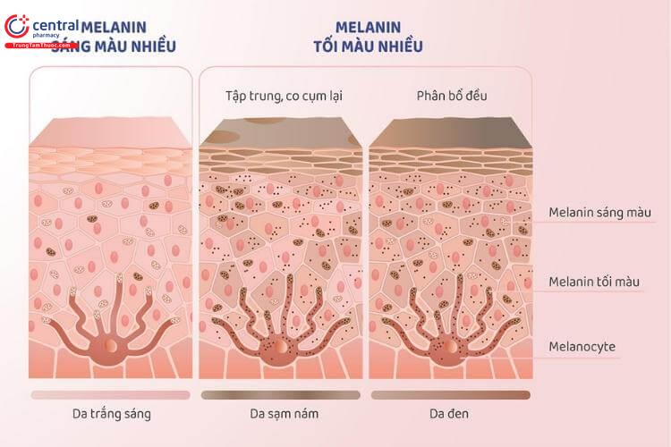 Sắc tố Melanin là gì? 6 cách làm giảm sắc tố Melanin nhanh nhất