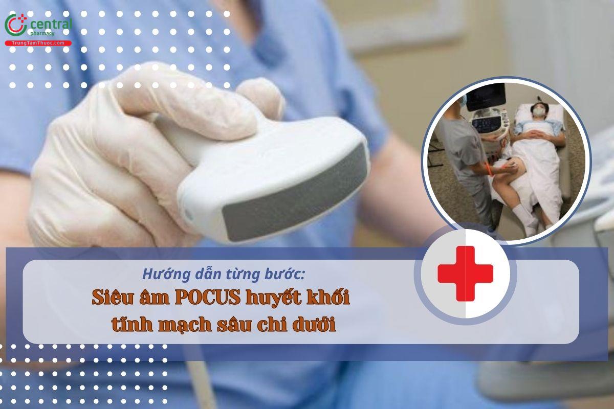 Siêu âm POCUS huyết khối tĩnh mạch sâu chi dưới: Hướng dẫn từng bước