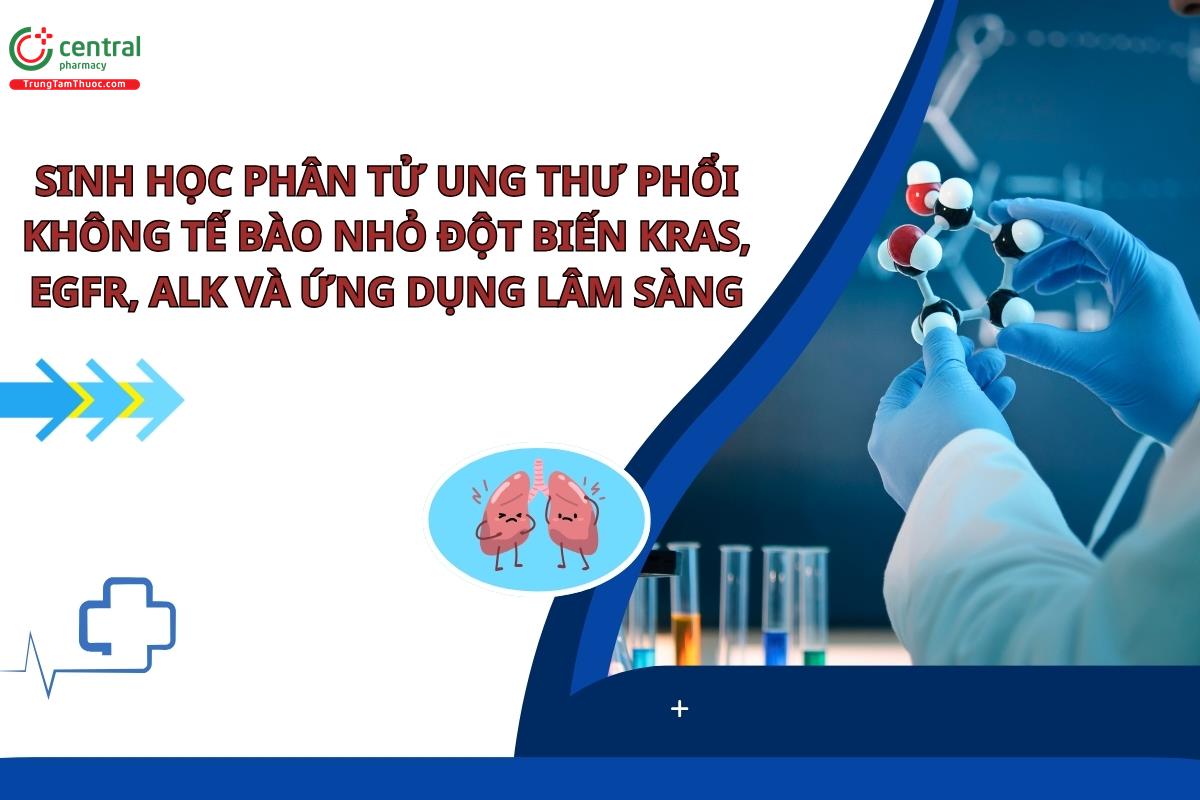 Sinh học phân tử ung thư phổi không tế bào nhỏ đột biến KRAS, EGFR, ALK và ứng dụng lâm sàng 