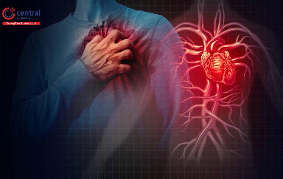 Sốc tim: Nguyên nhân, triệu chứng và phương pháp xử trí