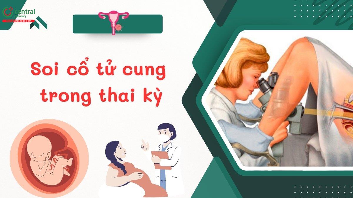 Soi cổ tử cung trong thai kỳ: Tổng quan chỉ định, quy trình đánh giá