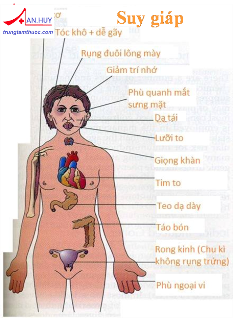 NGUYÊN NHÂN, TRIỆU CHỨNG VÀ ĐIỀU TRỊ SUY GIÁP Ở NGƯỜI LỚN