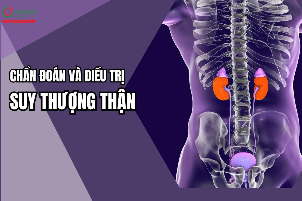 CHẨN ĐOÁN VÀ ĐIỀU TRỊ SUY THƯỢNG THẬN DO GLUCOCORTICOID THEO HỘI NỘI TIẾT CHÂU ÂU (ESE) 2024