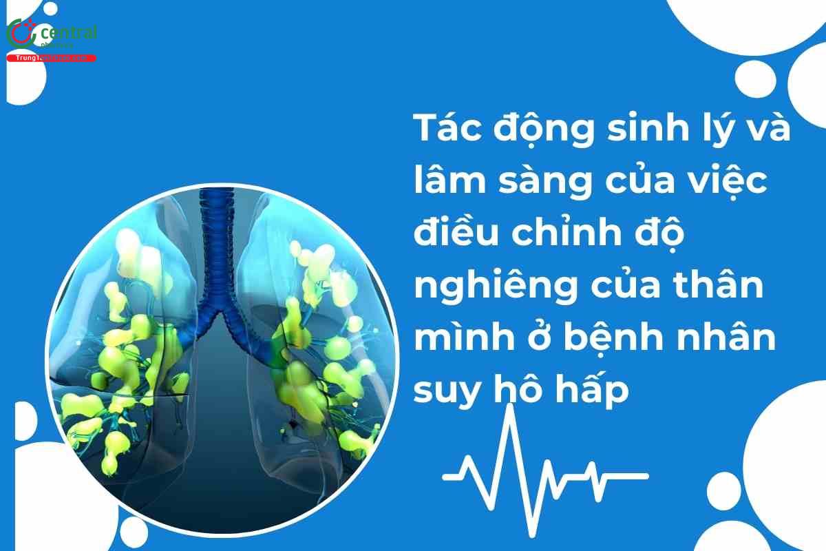 Tác động sinh lý và lâm sàng của việc điều chỉnh độ nghiêng của thân mình ở bệnh nhân suy hô hấp: tổng quan phạm vi và tổng hợp tường thuật 