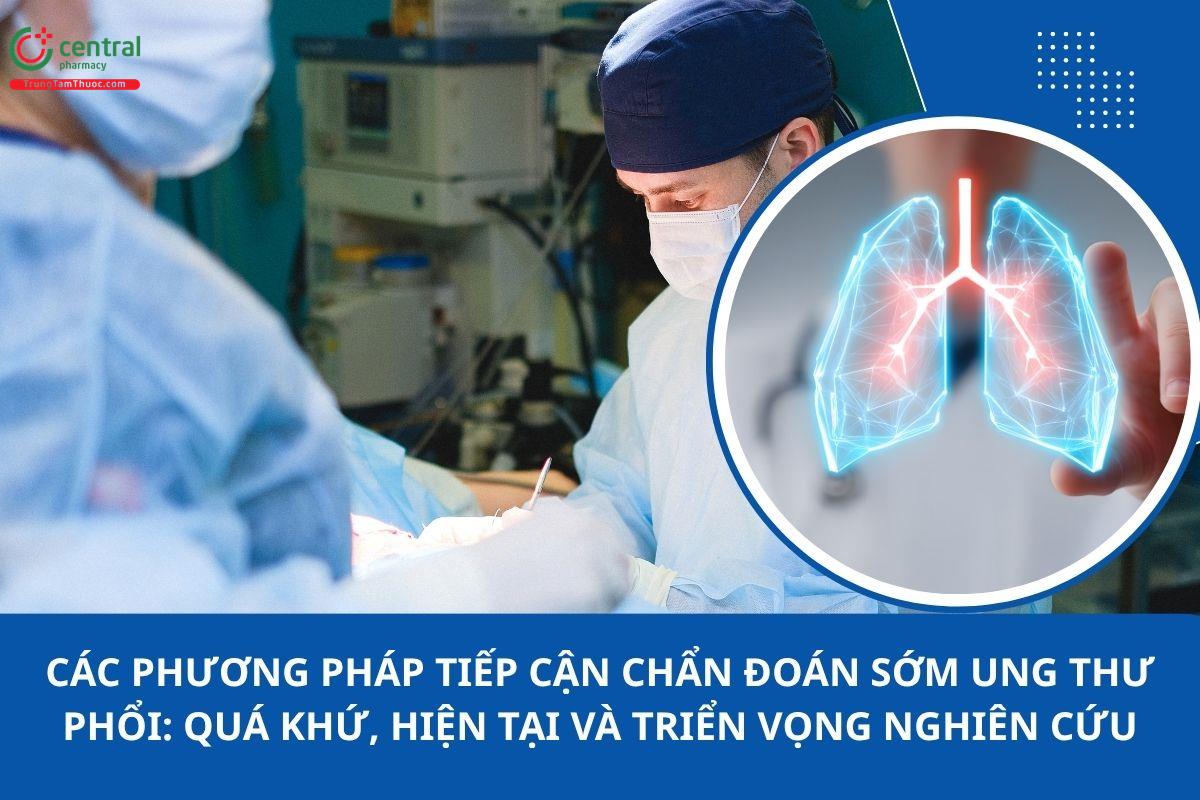 Các phương pháp tiếp cận chẩn đoán sớm ung thư phổi: quá khứ, hiện tại và triển vọng nghiên cứu