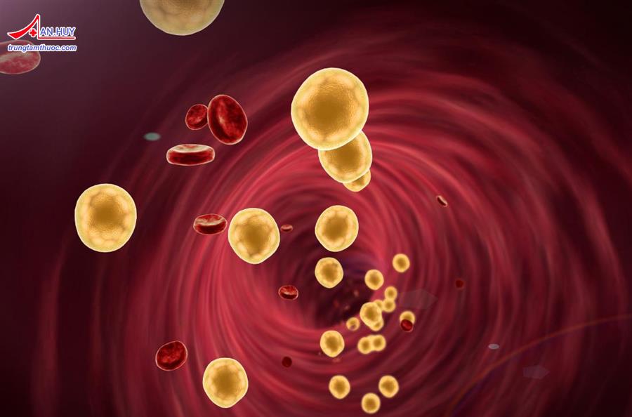 Nhóm thuốc hạ lipid máu: đại cương và thuốc cụ thể