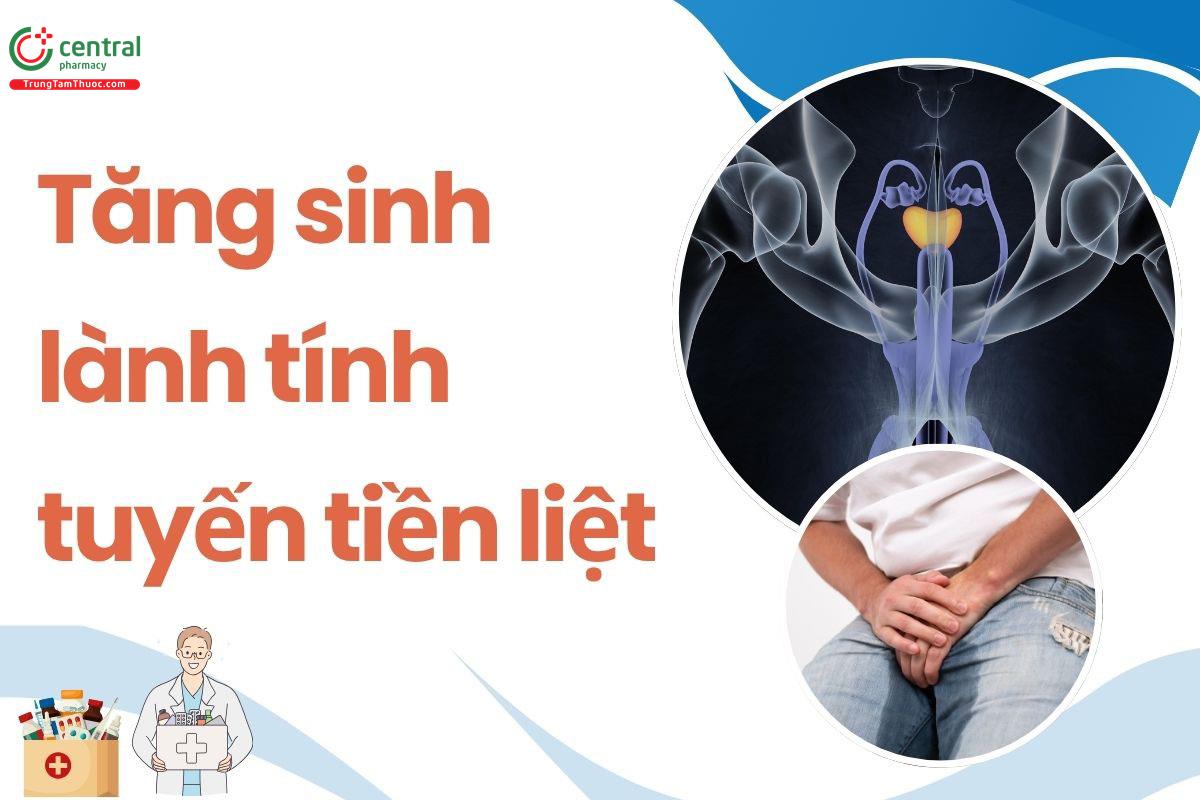 Tăng sinh lành tính tuyến tiền liệt: Nguyên nhân, biến chứng và hướng dẫn điều trị
