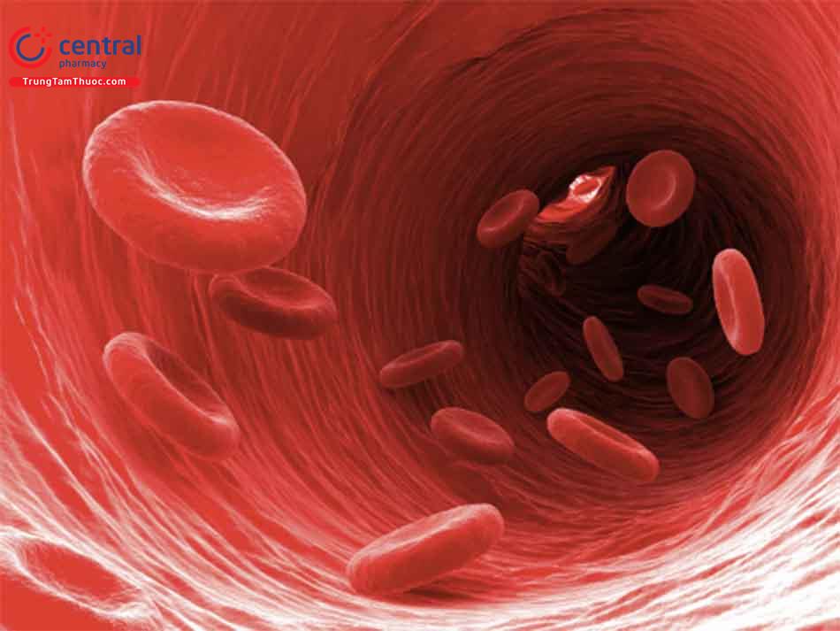 Thiếu máu ở bệnh nhân mắc bệnh thân mạn tính: nguyên nhân và điều trị