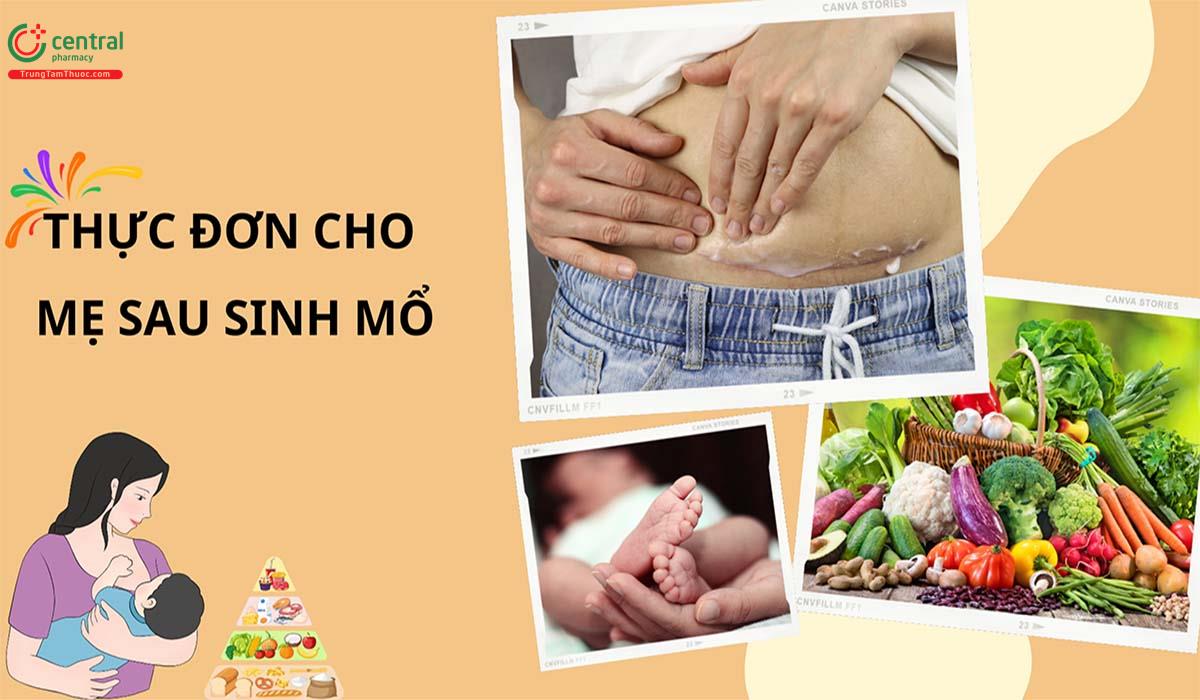 10+ thực đơn cho mẹ sau sinh mổ giúp liền sẹo, nhanh hồi sức