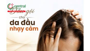 5 dầu gội cho da đầu nhạy cảm được chuyên gia khuyên dùng