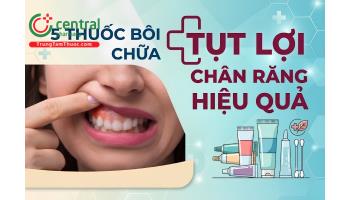 5 thuốc bôi chữa tụt lợi chân răng hiệu quả. Chữa tụt lợi hết bao nhiêu tiền?