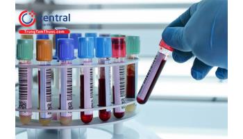 Cấu tạo máy phân tích tế bào máu ngoại vi và yếu tố ảnh hưởng đến chất lượng xét nghiệm tổng phân tích tế bào máu ngoại vi