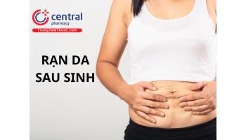 Rạn da sau sinh có tự hết không? Cách chữa rạn da sau sinh tại nhà