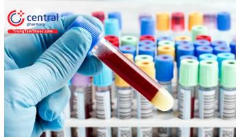 Cấu trúc của máy xét nghiệm đông máu và biện pháp kiểm soát chất lượng xét nghiệm đông máu