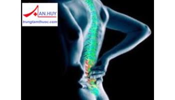 NGUYÊN NHÂN, CHẨN ĐOÁN VÀ ĐIỀU TRỊ TÌNH TRẠNG ĐAU THẮT LƯNG
