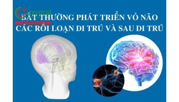 Bất thường phát triển vỏ não: các rối loạn di trú và sau di trú