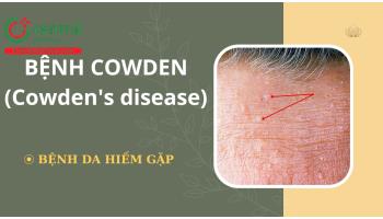 Bệnh Cowden (Cowden's disease): Căn nguyên, cách chẩn đoán và điều trị