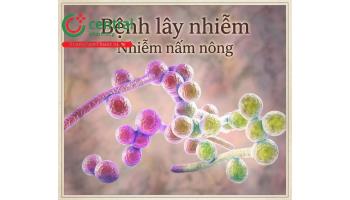 Bệnh lây nhiễm: Nhiễm nấm nông