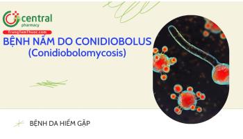 Dịch tễ, căn nguyên, triệu chứng Bệnh do Conidiobolus (Conidiobolomycosis)