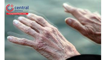 Bệnh Parkinson: nguyên nhân, triệu chứng và điều trị