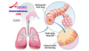 Bệnh phổi tắc nghẽn mạn tính đợt cấp và cách xử trí