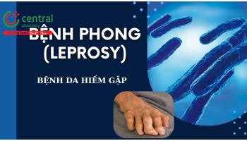 Bệnh phong (Leprosy): nguyên nhân, chẩn đoán và cách điều trị