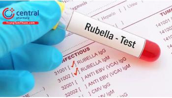 Bệnh Rubella: Nguyên nhân, chẩn đoán, biến chứng và điều trị