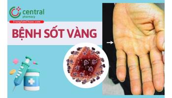 Bệnh sốt vàng: nguyên nhân, triệu chứng, chẩn đoán và vắc xin điều trị