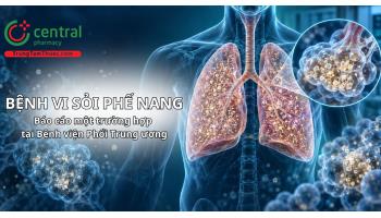 Bệnh vi sỏi phế nang: Báo cáo một trường hợp tại Bệnh viện Phổi Trung ương