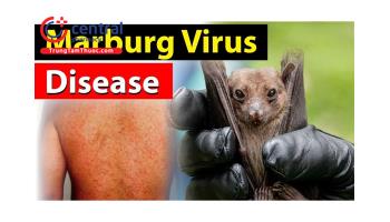 Virus Marburg - Lời cảnh báo về một bệnh dịch nguy hiểm mới