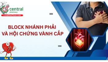 Block nhánh phải và hội chứng vành cấp – Những điều bác sĩ cấp cứu không được quên