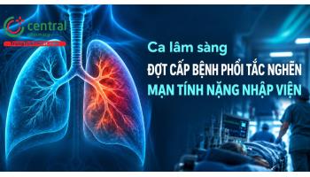 Ca lâm sàng: Đợt cấp bệnh phổi tắc nghẽn mạn tính nặng nhập viện