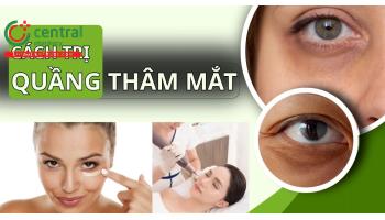 Cách trị quầng thâm mắt tại nhà hiệu quả và an toàn