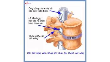 Những điều cần biết trong điều trị thoát vị đĩa đệm