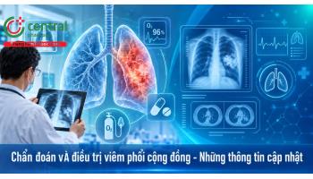 Chẩn đoán và điều trị viêm phổi cộng đồng - Những thông tin cập nhật