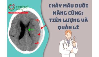 Chảy máu dưới màng cứng: Tiên lượng và quản lí, phương pháp điều trị